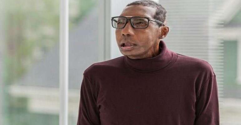 World's First Face Transplant in a Black Patient Brought Special Challenges